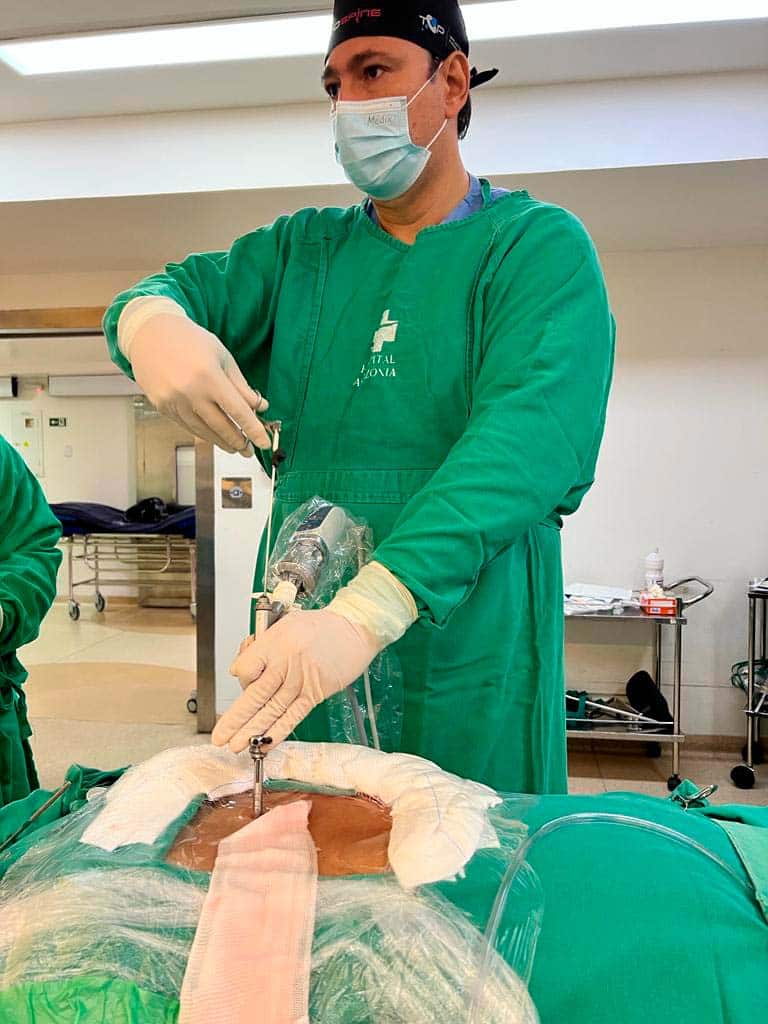 Dr. Marcio Penna fazendo uma cirurgia endoscópica da coluna