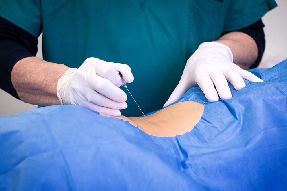 Mão de médico fazendo tratamento de bloqueio com agulha para dor na coluna - Site Dr. Márcio Penna - ortopedista especialista em coluna