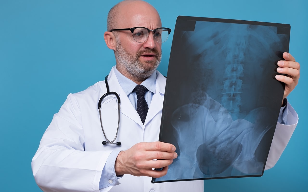cirurgião de coluna vendo o raio-x do resultado de cirurgias minimamente invasivas da coluna - site Dr. Marcio Penna cirurgião de coluna de Belém - PA